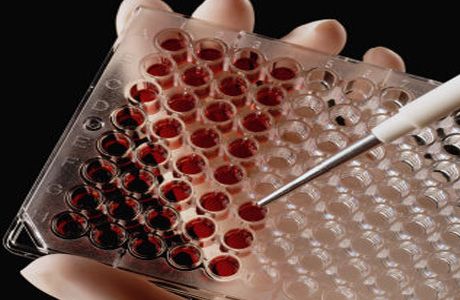 HIV heteroseksuaalne levik: uued avastused