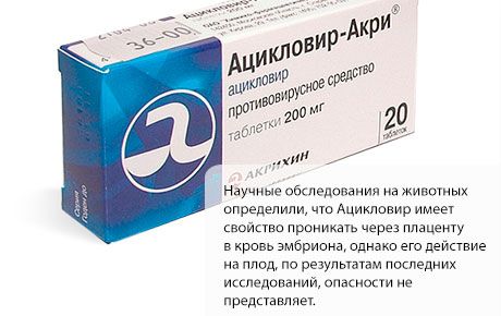 Acyclovir raseduse ajal