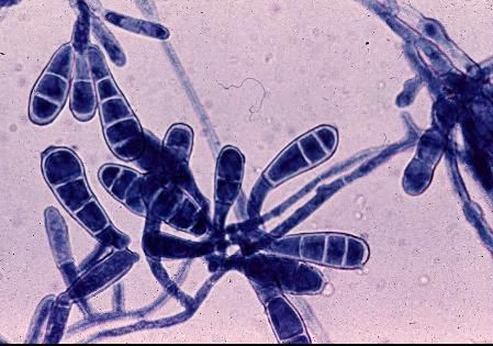 Reieluu epidermofüüti (Epidermophyton floccosum)